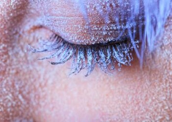 Kaip atpažinti nušalimą ir kaip elgtis nušalus?