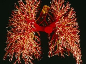 Po plaučių transplantacijos – devinti laimingo gyvenimo metai