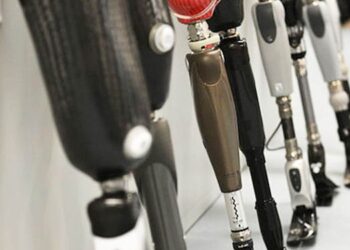 Modernūs protezai gali būti kompensuojami bet kokio amžiaus pacientams