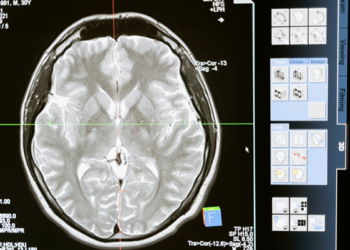 magnetinis rezonansas