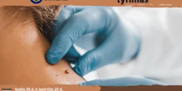 Palangoje siūlomas nemokamas apgamų dermatoskopinis tyrimas